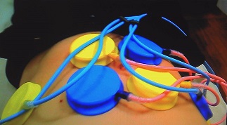 EMS�g���[�j���O�Ń_�C�G�b�g�I