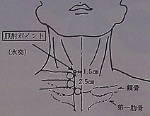 ����_�o��